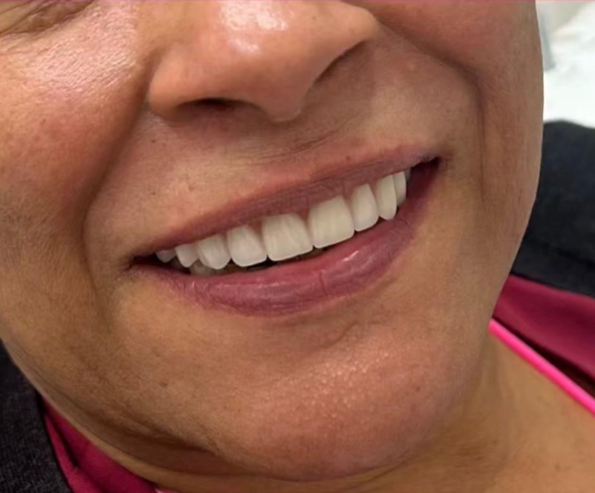 Close do sorriso após o tratamento