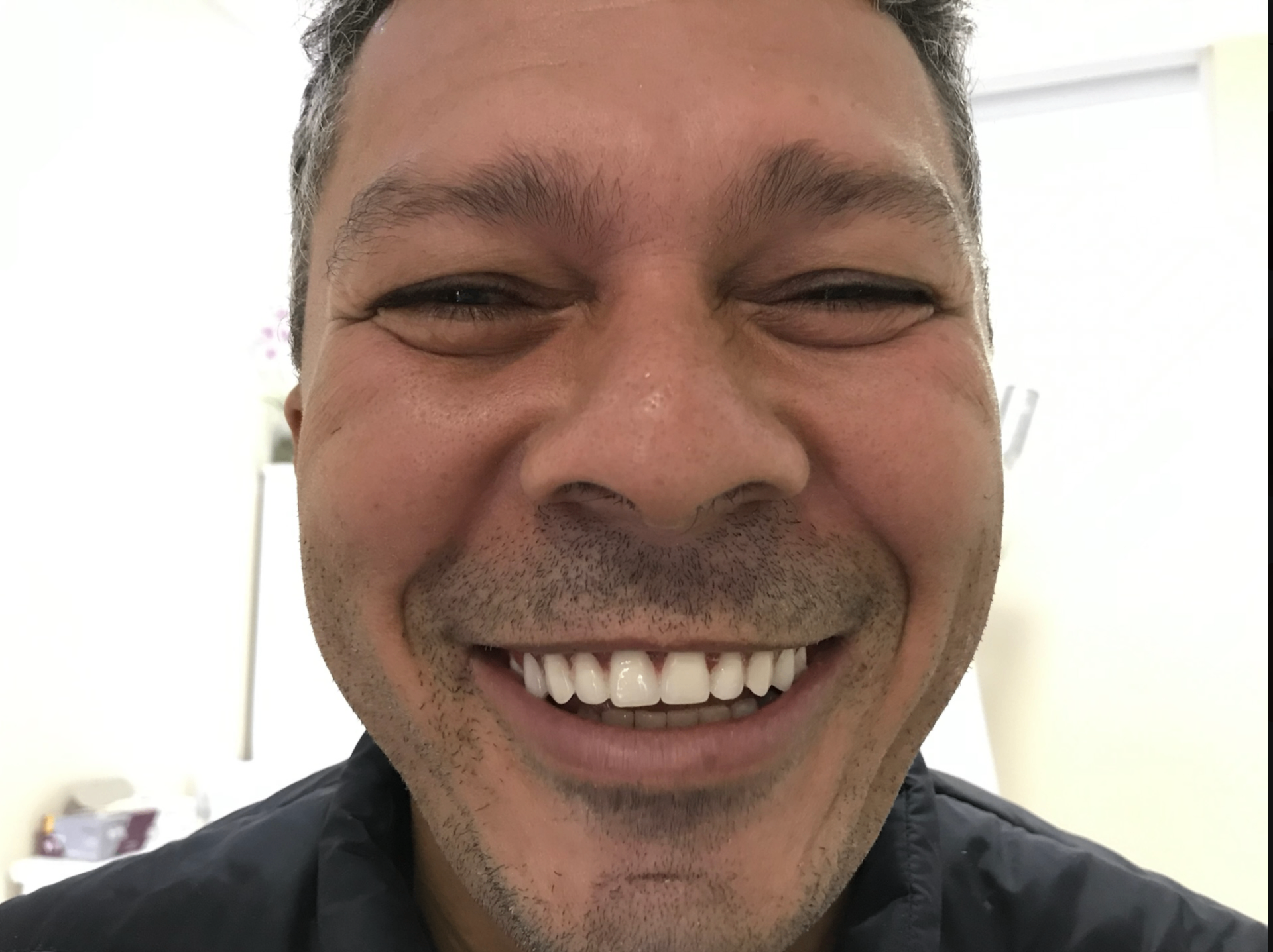 Sorriso após reabilitação completa
